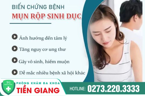 thumb bai viet