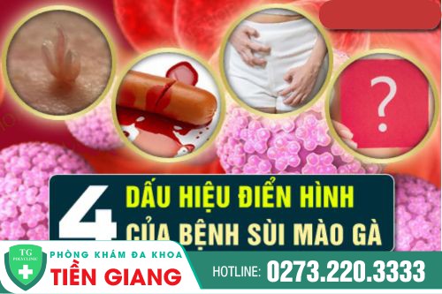 thumb bai viet